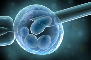 Фото: Процедура крио протокола