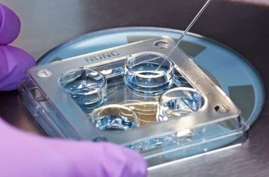 Фото: Подготовка к подсадке эмбрионов