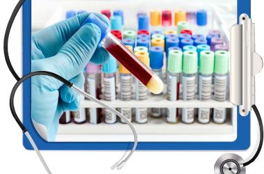 Фото: Укол ХГЧ перед пункцией ЭКО